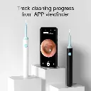 Generic Wifi Intelligent Visual Earpick Mini Camera Endoscope Mobile Lens Ear Cleaning Tool for All Cell Phone (White) 2.webp