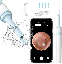 Generic Wifi Intelligent Visual Earpick Mini Camera Endoscope Mobile Lens Ear Cleaning Tool for All Cell Phone (White) 